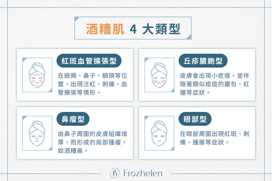 酒糟肌 4 大類型